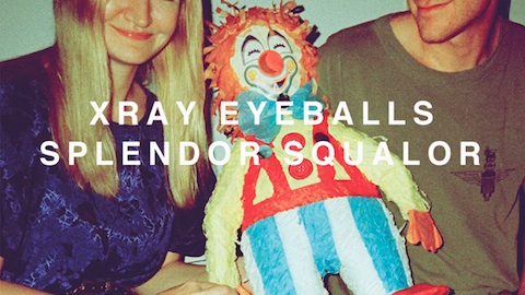 Exclusive Download: Xray Eyeballs: “X”