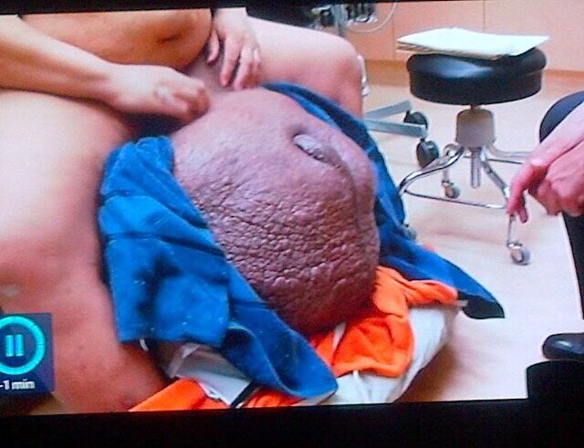 10 man testicles with stone 140 Pound